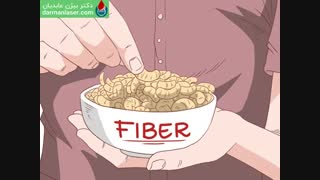درمان فیستول مقعدی (آبسه) با لیزر در یک جلسه بدون درد و خونریزی توسط دکتر بیژن عابدیان ماموپلاستی