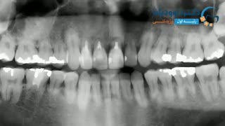 دکتر ارتودنسی | دکتر داوودیان