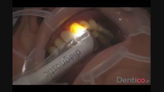 کامپوزیت aura کمپانی sdi