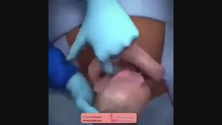 درمان قطعی عفونت زنان