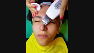 پاکسازی صورت - 22807060