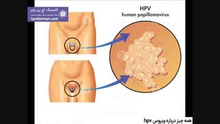 هر آنچه که باید درباره ویروس اچ پی وی hpv بدانید