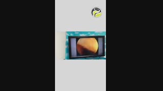 نکات مهم در کولونوسکوپی استاندارد