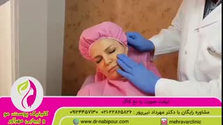 لیفت صورت با نخ کاگ