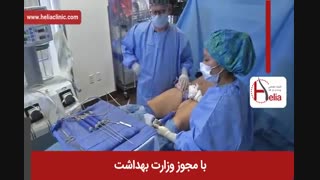 لیپوماتیک | فیلم لیپوماتیک | کلینیک پوست و مو هلیا | 18