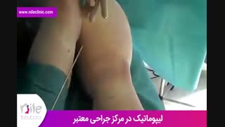 لیپوماتیک | فیلم لیپوماتیک | کلینیک پوست و مو نیل | شماره 18