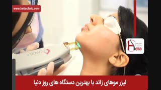 لیزر موهای زائد | فیلم لیزر موهای زائد | کلینیک پوست و مو هلیا | شماره 16