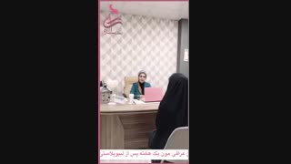 ویزیت بعد از لابیاپلاستی