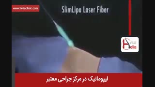 لیپوماتیک | فیلم لیپوماتیک | کلینیک پوست و مو هلیا | شماره 20