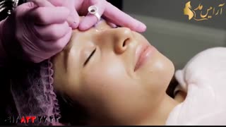 فیلم آموزش گام به گام میکرونیدلینگ ابرو