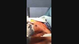 فیلم جراحی ماستکتومی رادیکال برای کانسر پستان