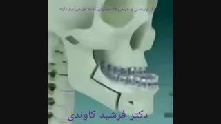 مراحل ارتودنسی و جراحی فک