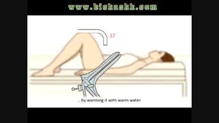 کاربرد تست پاپ اسمیر چیست؟ انجام این آزمایش از چه سنی شروع می شود؟