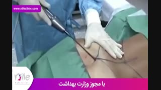 لیپوماتیک | فیلم لیپوماتیک | کلینیک پوست و مو نیل | شماره 20