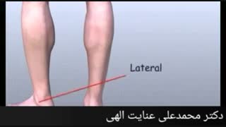 تقویت مچ پا جهت جلوگیری از پیچ خوردگی های مکرر