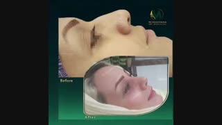 نمونه کار جراحی بینی در لرستان
