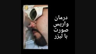 فیلم لیزر واریس صورت اصلاح طرح لبخند