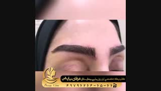 فیلم نمونه کاشت ابرو