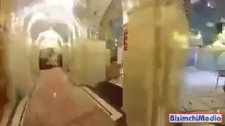 یا رقیه، دورت بگردم جراحی زیبایی پلک