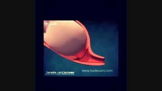 انیمیشن زایمان طبیعی | دکتر فریبا خطیر جراح و متخصص زنان و زایمان