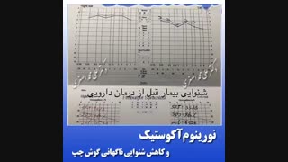 جراحی کاهش شنوایی ناگهانی گوش