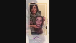 جراحی زیبایی بینی