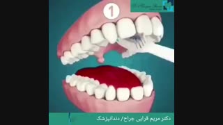 فیلم روش درست مسواک زدن