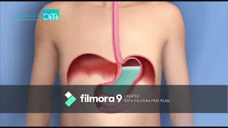 رفلاکس معده