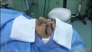 جراحی بینی