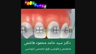 روش درست نخ دندان کشیدن