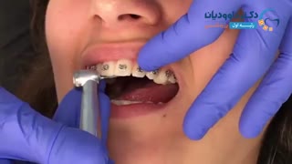 ارتودونسی شرق تهران | دکتر داوودیان