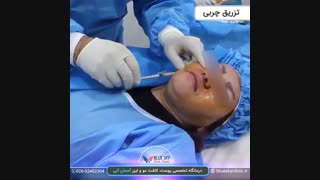 تزریق چربی - 02632402304
