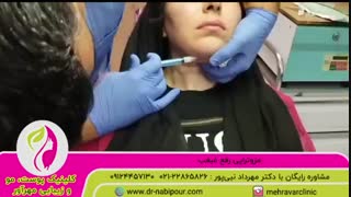مزوتراپی رفع غبغب