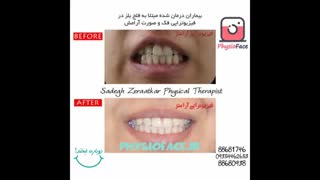 درمان تخصصی فلج بلز، فیزیوتراپیست صادق زراعتکار