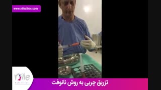 تزریق چربی | فیلم تزریق چربی | کلینیک پوست و مو نیل | شماره 22