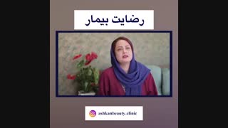 فیلم رضایت بیمار پس از جراحی پلک
