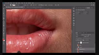 آموزش حذف پرزهای صورت