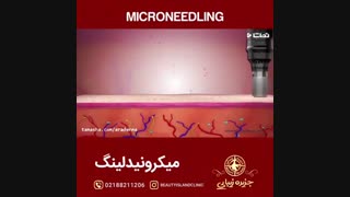 میکرونیدلینگ به روایت تصویر