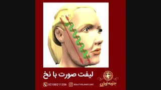 لیف صورت با نخ
