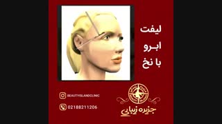لیفت ابرو