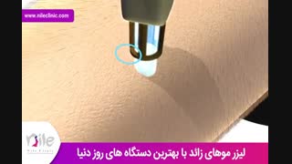 لیزر موهای زائد | فیلم لیزر موهای زائد | کلینیک پوست و مو نیل | شماره 23