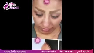 جراحی زیبایی بینی