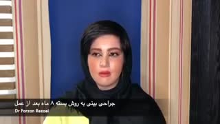 فیلم بعد از عمل بینی