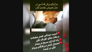 جراحی تعویض قدامی مفصل لگن
