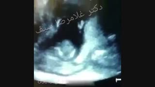 پدری و مادری که آواز می خوانند و جنین در شکم مادر دست می زند