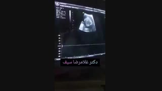 سونوگرافی جنین در 19 هفته