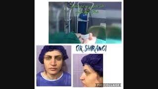 جراحی زیبایی بینی (نیمه فانتزی)