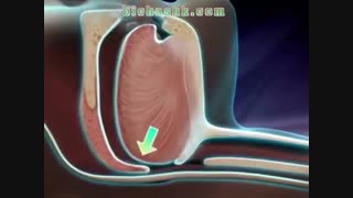 از خرو پف شریک زندگی خود خسته شده اید، با درمان خروپف آشنا شوید! - بیچشک