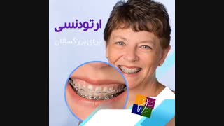 ارتودنسی برای بزرگسالان