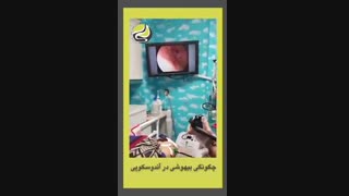 چگونگی بیهوشی در آندوسکوپی